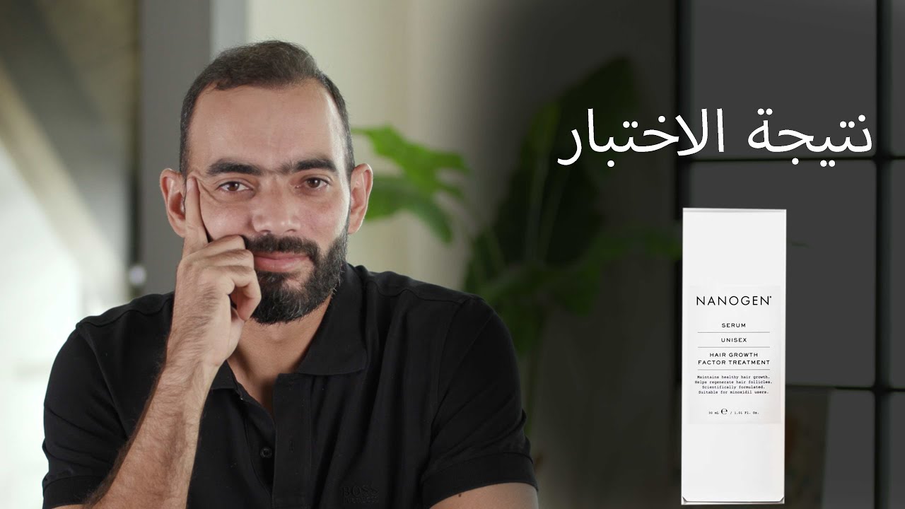 نتيجة اختبار نانوجين للشعر