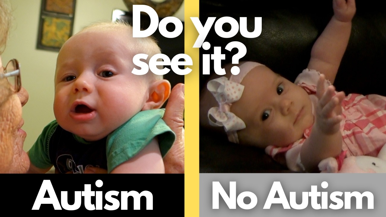 4 Signs of Autism in a Newborn