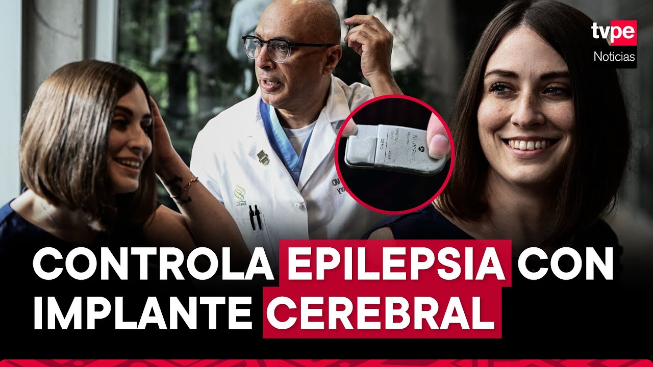 Mujer con epilepsia controla su enfermedad gracias a chip implantado en el cerebro