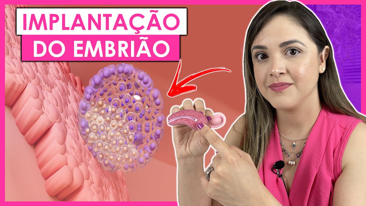 SINTOMAS DA IMPLANTAÇÃO DO EMBRIÃO NO ÚTERO