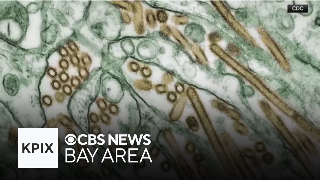 What to know about the flu this winter season