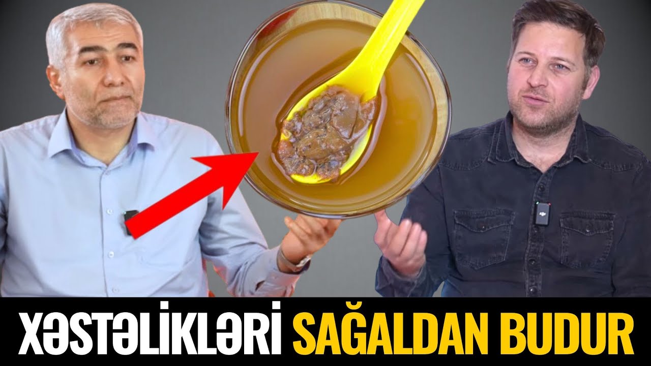 Qızılca və Qripdən necə qorunaq? - İnsanlardan nəyi gizlədirlər? / Fizuli Hüseynov