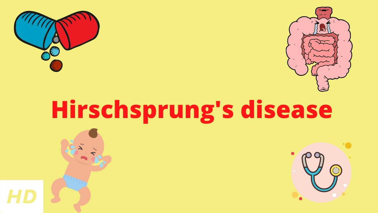 Hirschsprung's Disease, Causes, Signs and Symptoms, Diagnosis and Treatment.