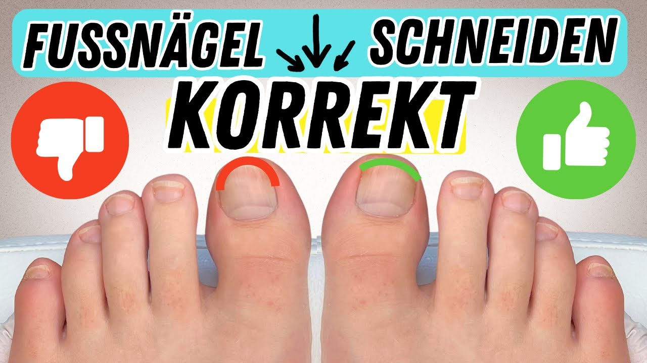 FUSSNÄGEL RICHTIG SCHNEIDEN | So schneidest du Zehennägel richtig & vermeidest EINGEWACHSENE NÄGEL