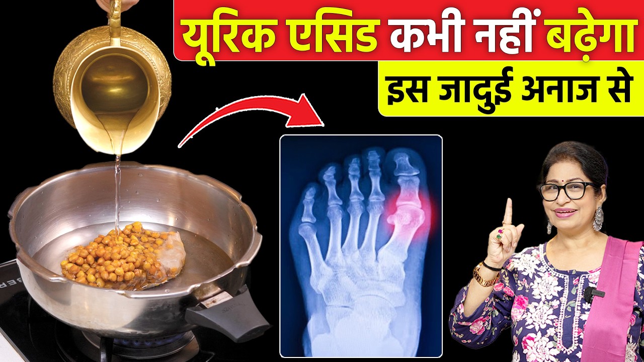 रोज दाल खाने वालो पहले ये VIDEO देख लो - अब यूरिक एसिड कभी नहीं बढ़ेगा | Control Uric Acid Naturally