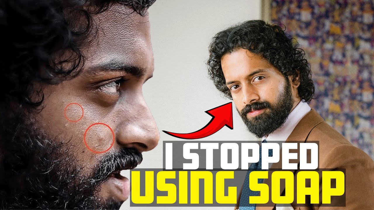 🥬Remove PIMPlES Overnight?🧴20 Narural METHODS