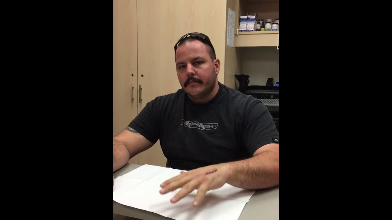 4th Metacarpal FX Surgery