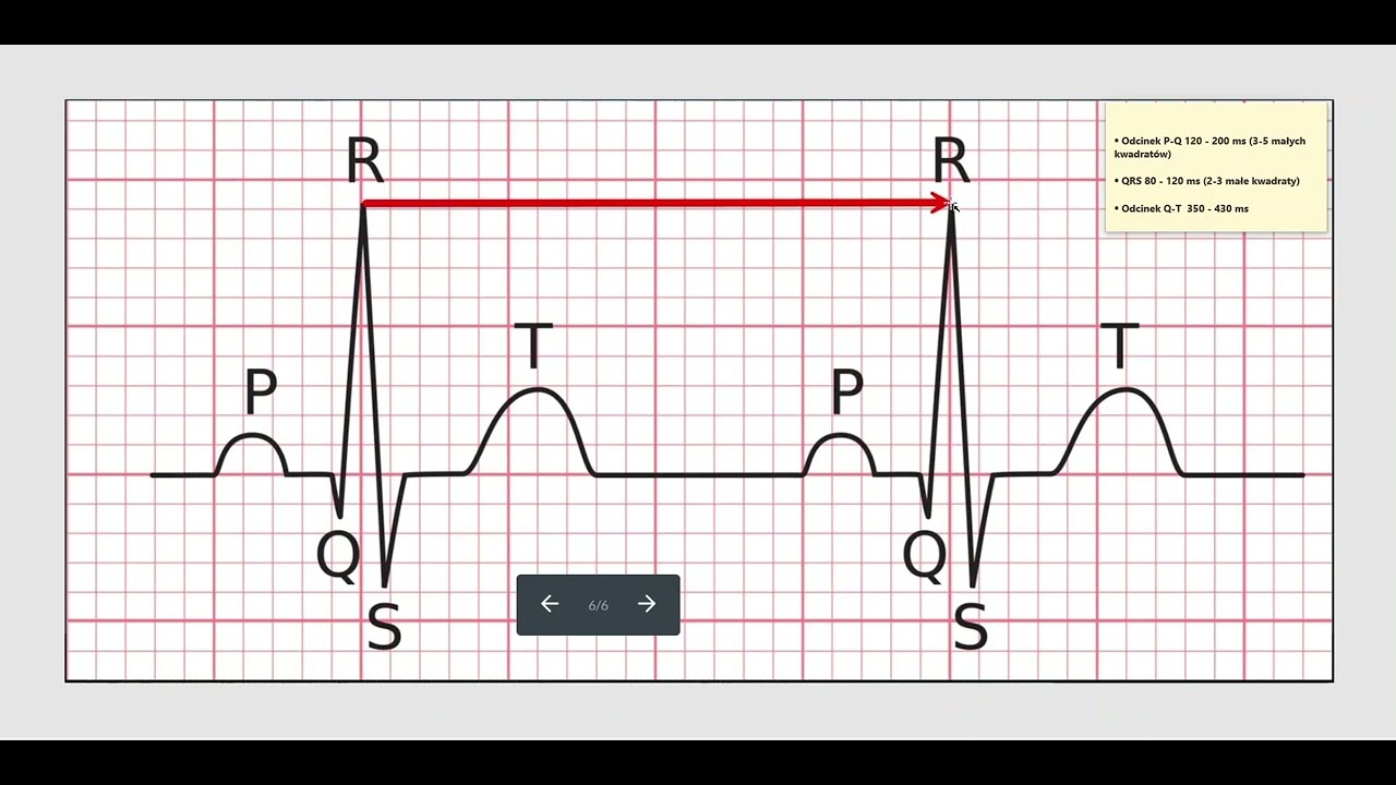 2. Podstawy EKG - obliczanie tętna w EKG i załamków.