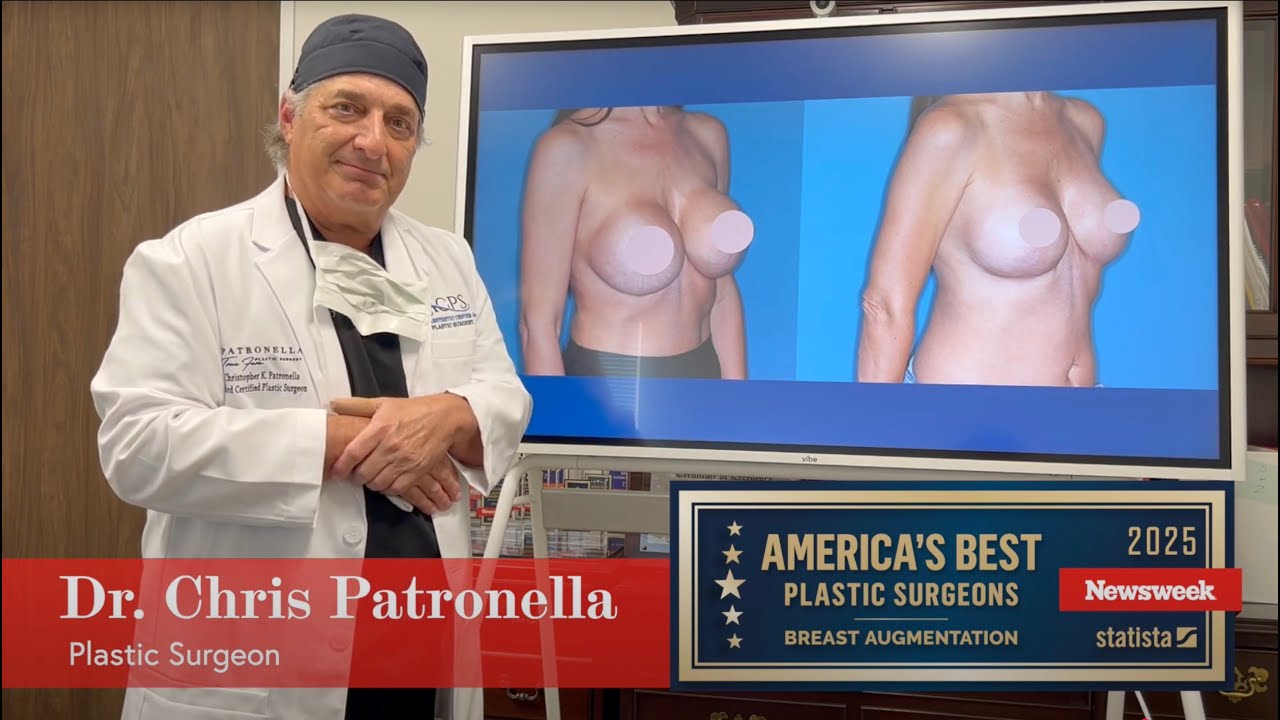 Breast Implant Revision: Restoring a Natural Appearance
