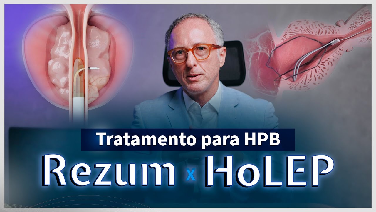 Qual melhor procedimento para HPB: REZUM ou HOLEP?