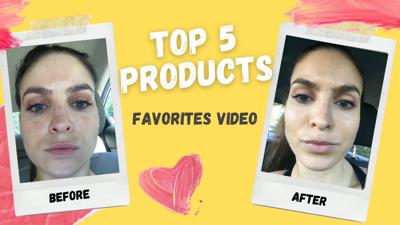 TOP 5 PRODUCTS TO TREAT HYPERPIGMENTATION AND MELASMA | Musely Review