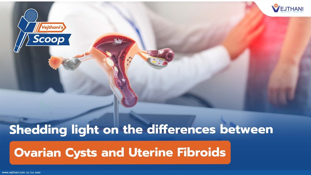 Shedding light on the differences between Ovarian Cysts and Uterine Fibroids