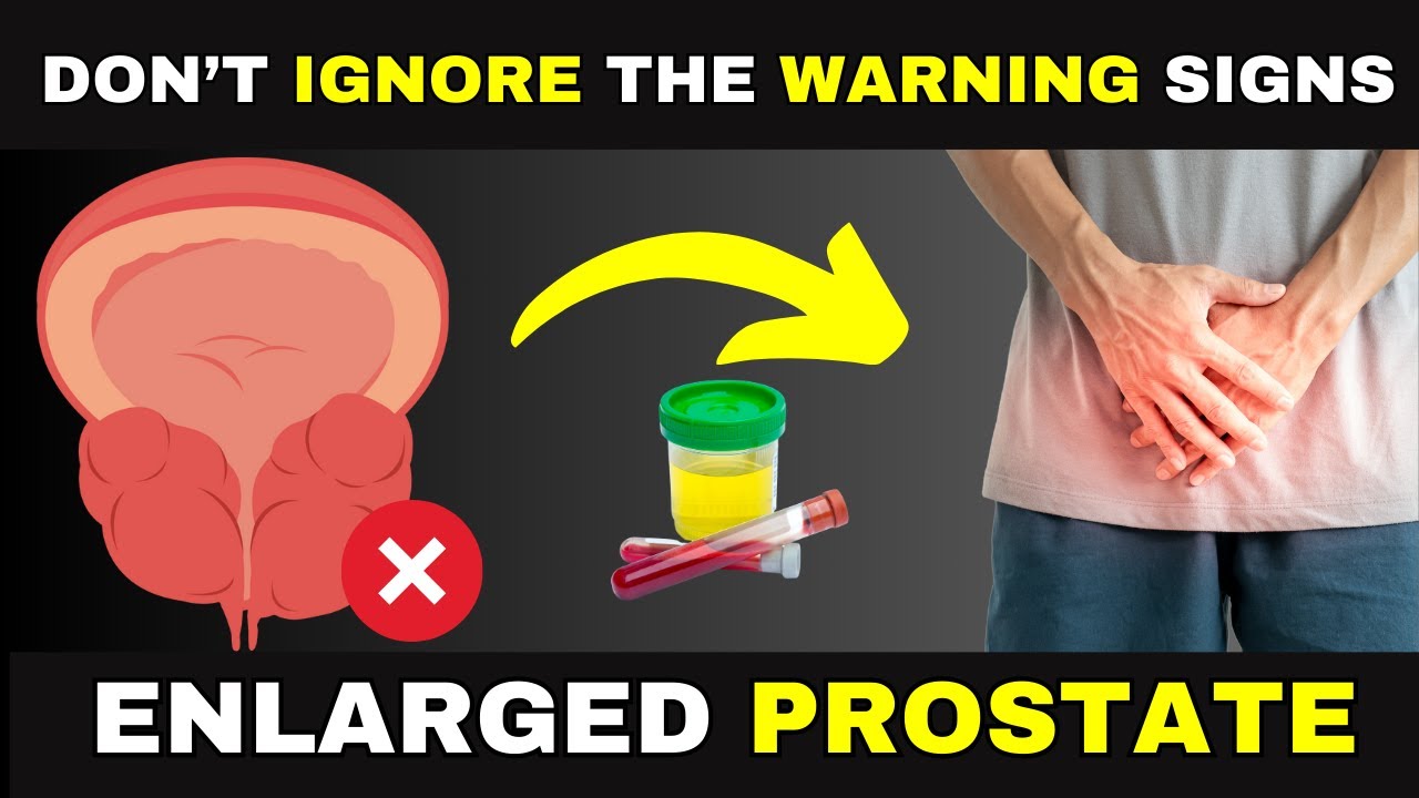 Enlarged Prostate (BPH) - Warning Signs & Symptoms You Shouldn't Ignore