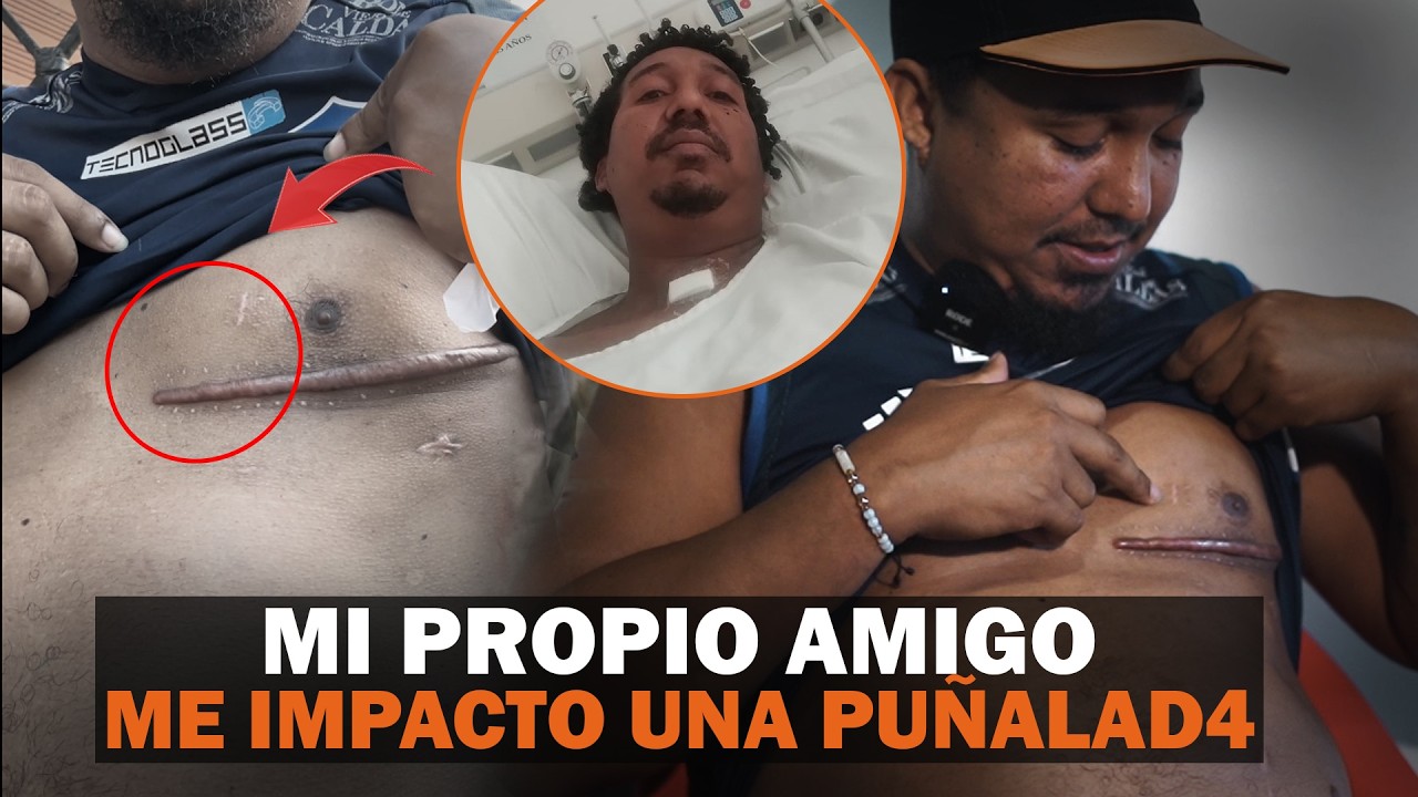 ME RECOGIERON EN LA MORGUE - Mi propio amigo me impacto una puñalad4 - EPISODIO 1