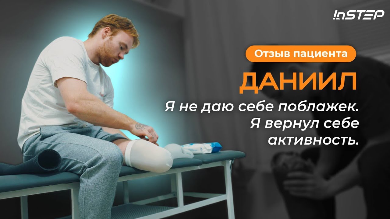 Чувствительная культя. Протез на короткую культю. Отзыв пациента Даниила