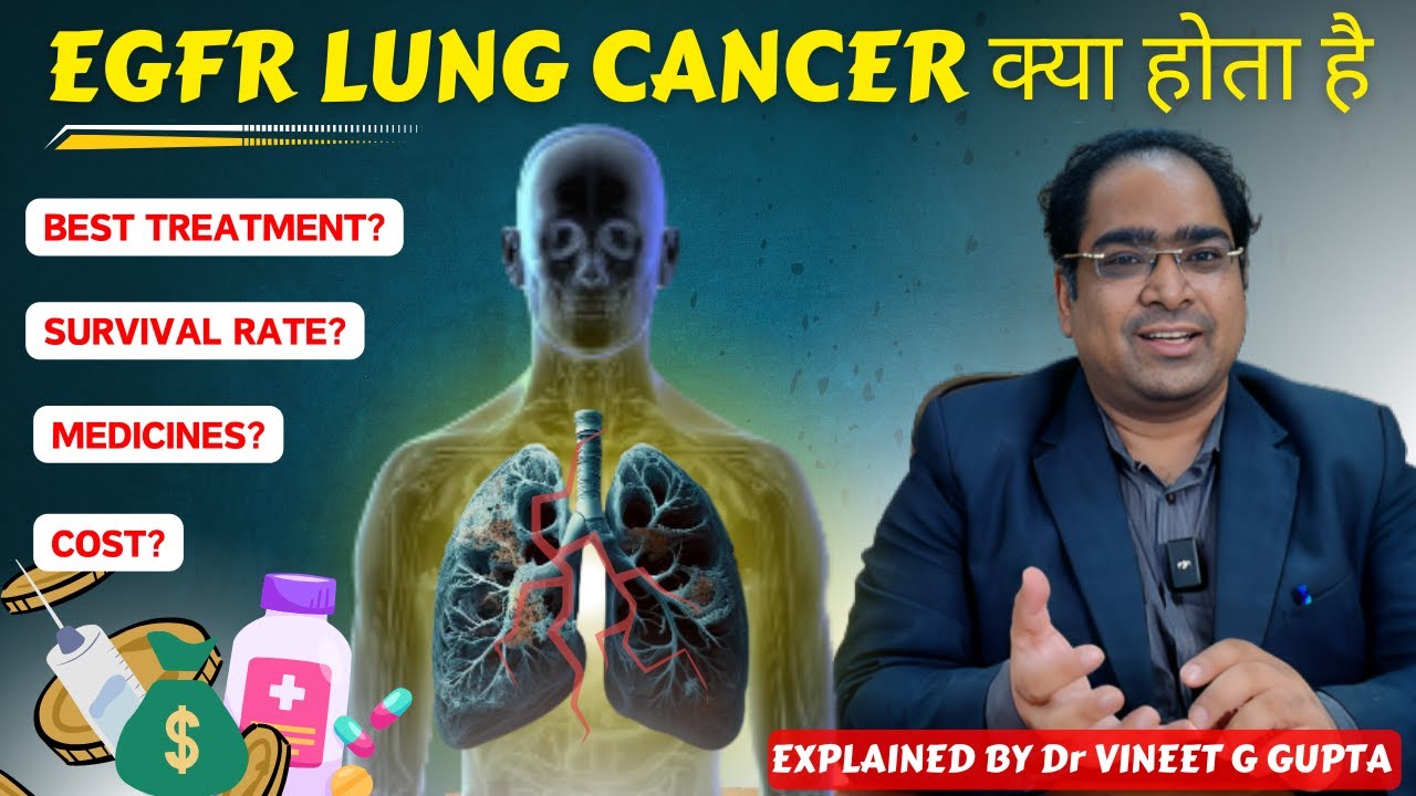 ईजीएफआर स्टेज 4 फेफड़ों कैंसर इलाज DM(AIIMS) - टागरिस्सो ओसिमर्टिनिब कैंसर की गोली, सर्वाइवल, कीमत