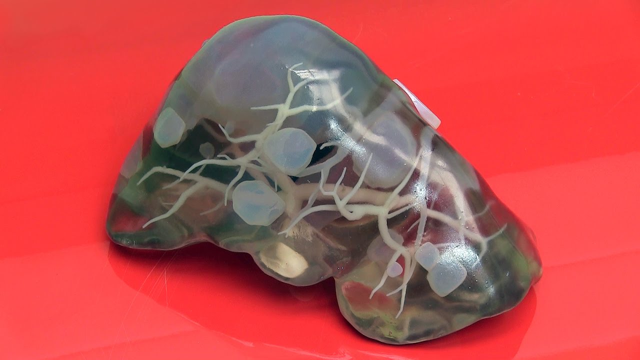 Medical 3D Printing