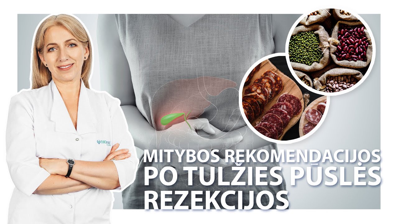 Mitybos rekomendacijos po tulžies pūslės rezekcijos  | Gastroenterologė Rasa Makarevičienė