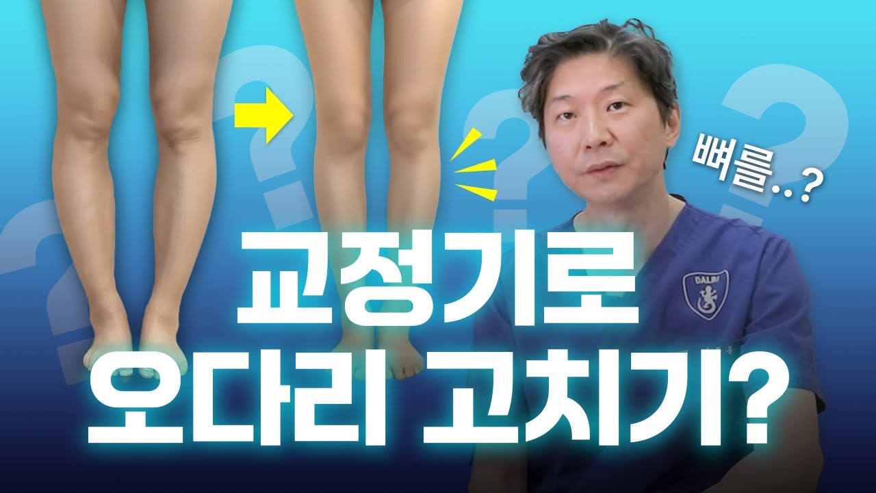 교정 깔창이나 교정 운동으로 오다리 교정이 가능할까?🧐 | 휜다리 총정리 Ep.오다리편 |
