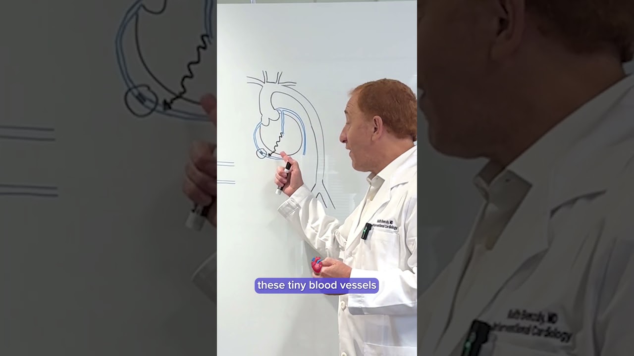 What Is Chronic Total Occlusion?
