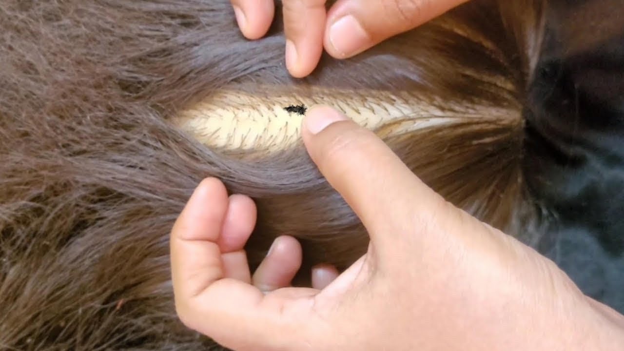 ASMR Scalp Check: The Most Relaxing Experience Ever✨