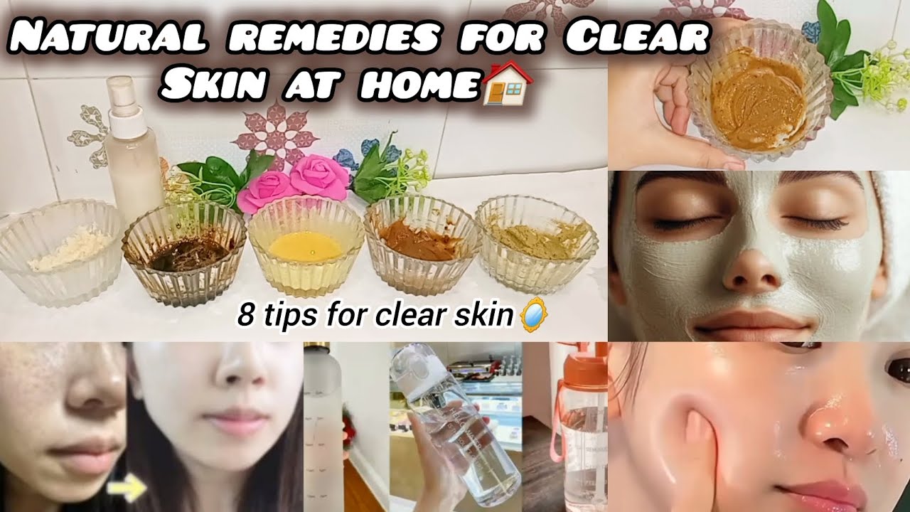 HOW TO GET CLEAR SKIN WITH OUT SPENDING MONEY 💰🤗