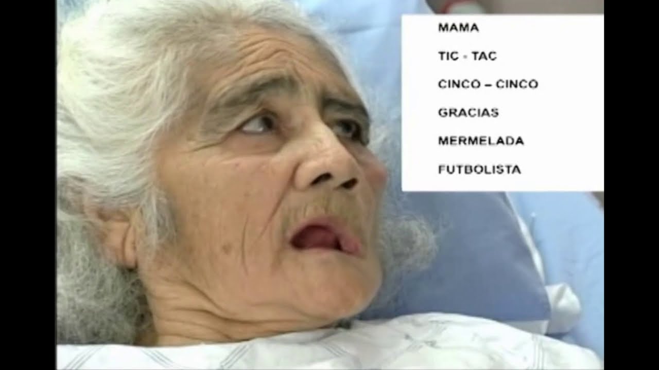 13/14 Escala NIHSS STROKE: Disartria