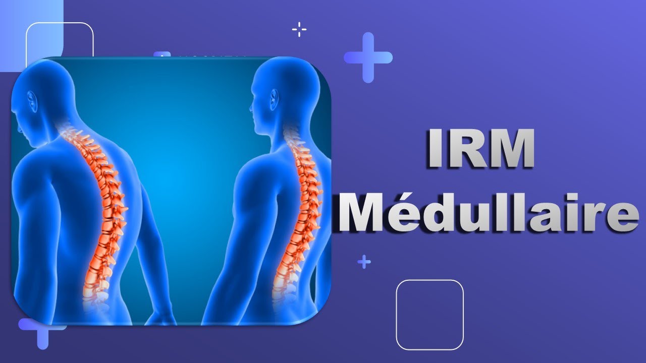 IRM Médullaire -Bonne Pratique_