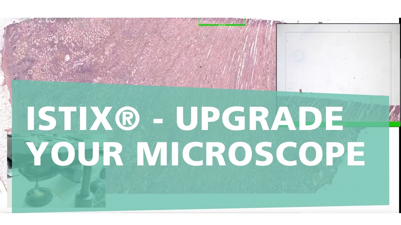 iSTIX® - upgrade your microscope into a whole-slide-scanner