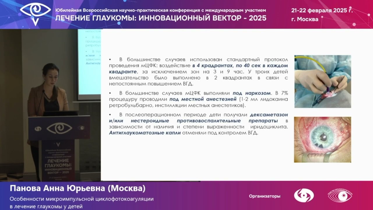 Особенности микроимпульсной циклофотокоагуляции в лечении глаукомы у детей