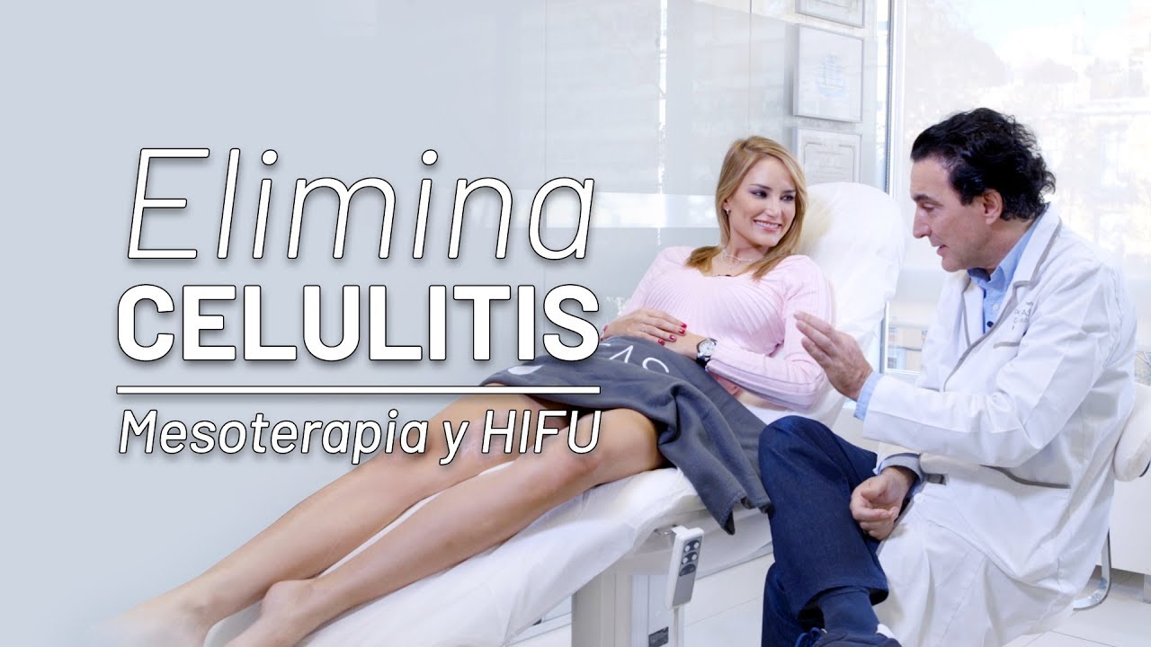 Alba Carrillo Elimina CELULITIS [Mesoterapia + HIFU Corporal]