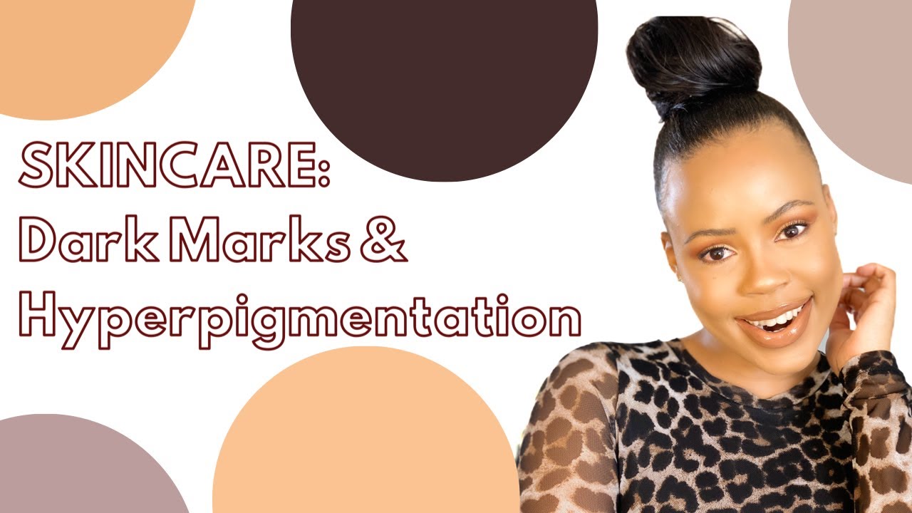 How to get rid of DARK MARKS & HYPERPIGMENTATION 