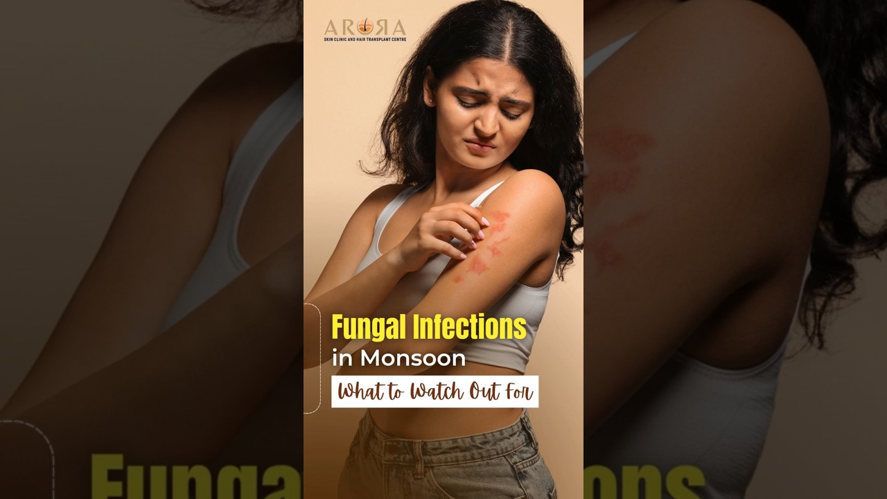 Monsoon Skin Problems? Visit Skin Expert in Surat &ndash; Dr. Tanu Arora