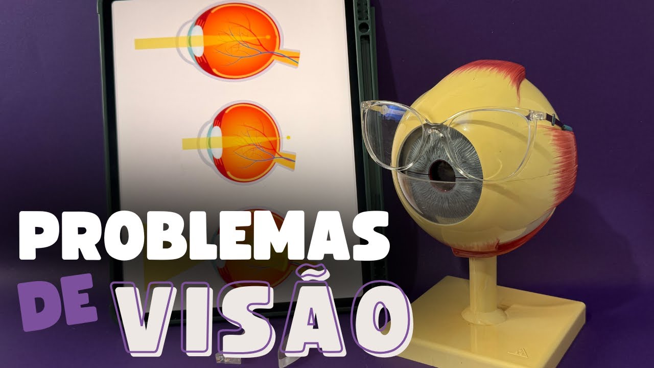 Problemas de visão: miopia, hipermetropia e astigmatismo (6º ano)