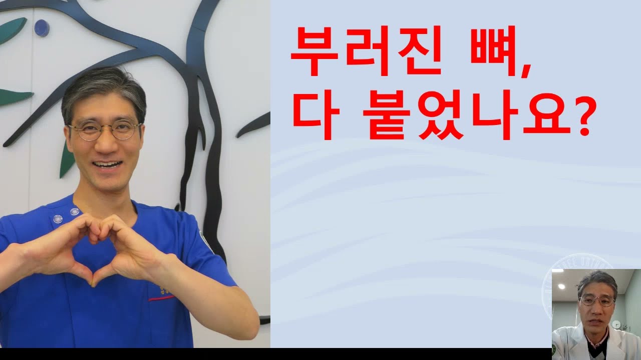 (올리브나무 정형외과) 뼈가 다 붙었나요? (골절 유합)