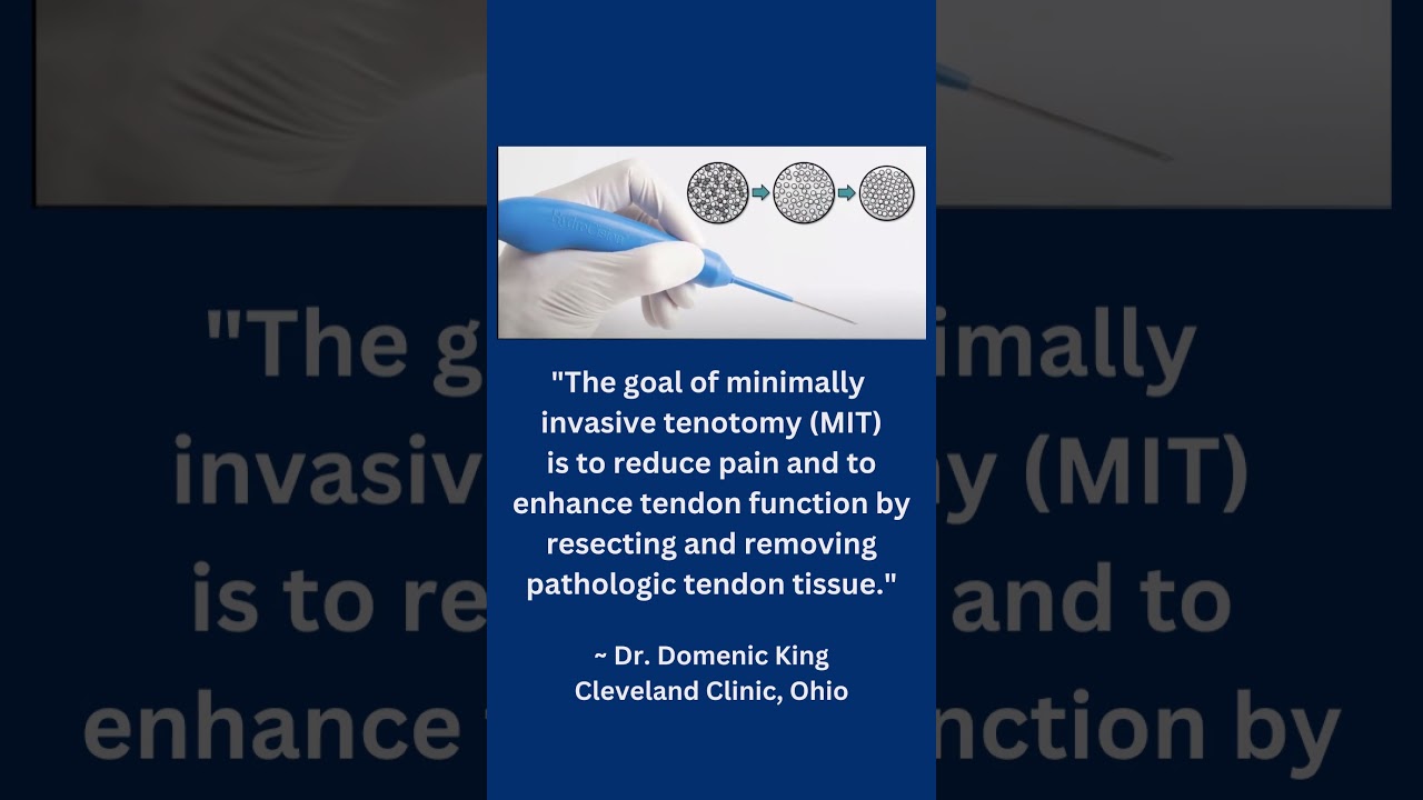 Minimally invasive tenotomy and tendinopathy