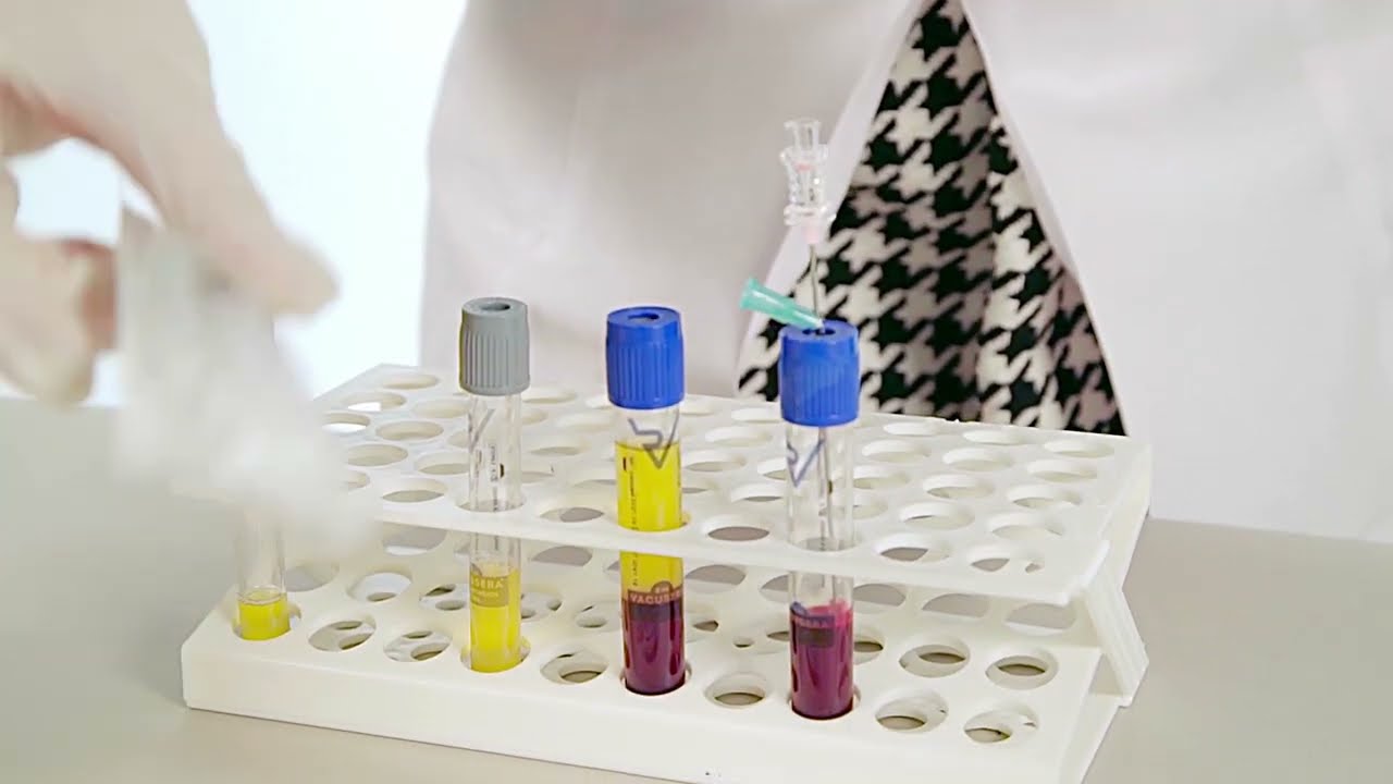 Vacusera PRP-Röhrchen