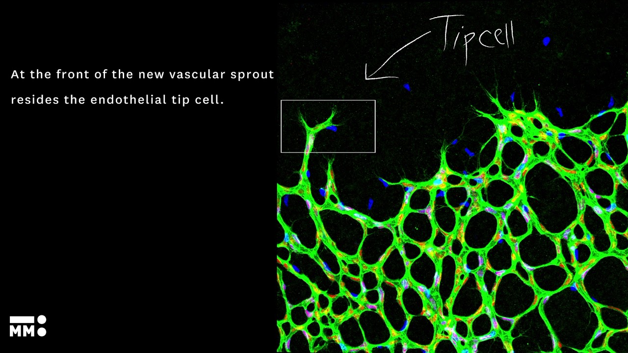 What is angiogenesis?