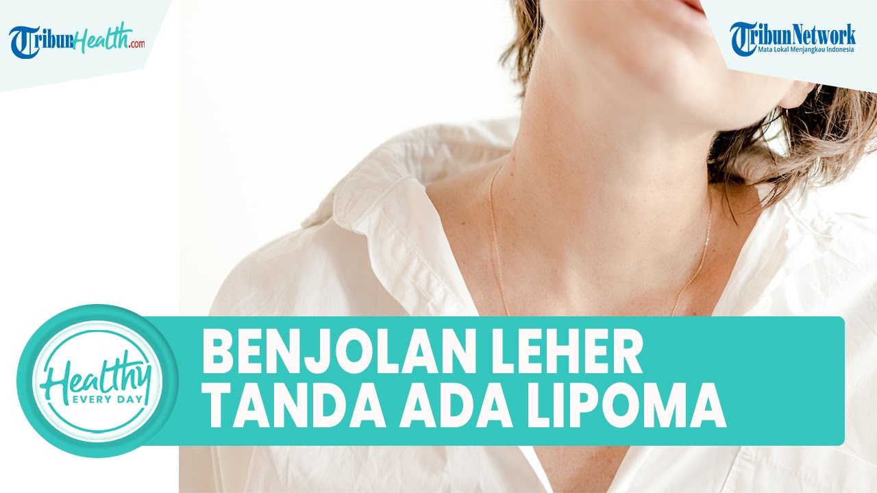 Waspadai Benjolan di Area Leher Tanda Adanya Lipoma, Kenali Penyebab Kelenjar Getah Bening Membesar