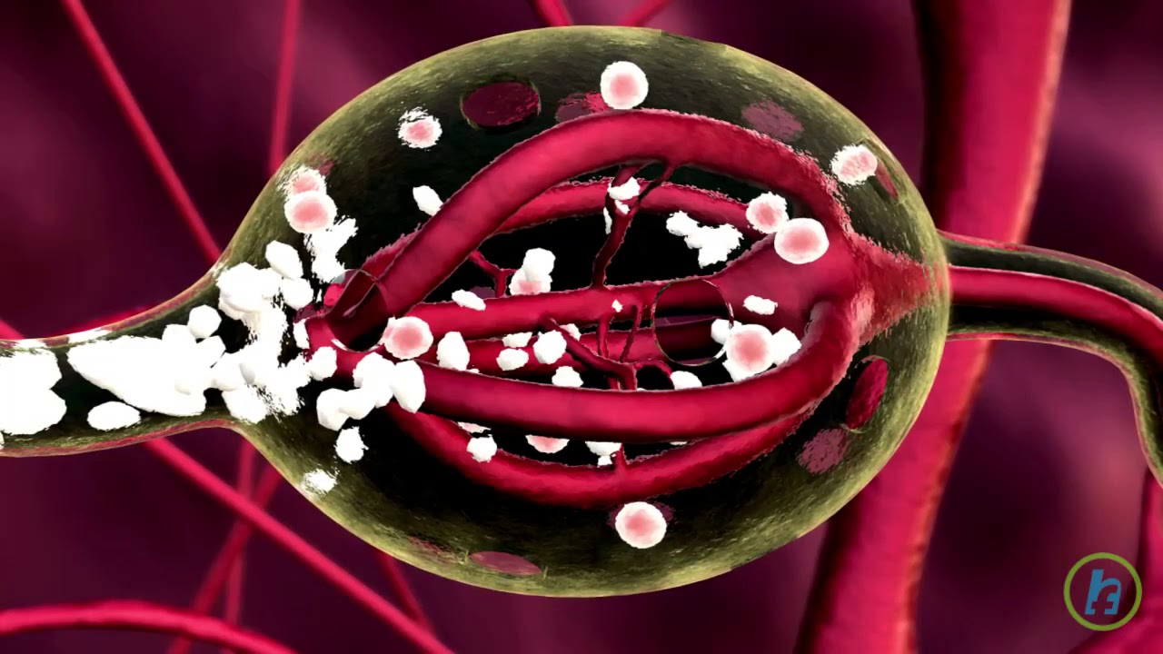 FACTS  ABOUT ESOPHEGEAL CANCER