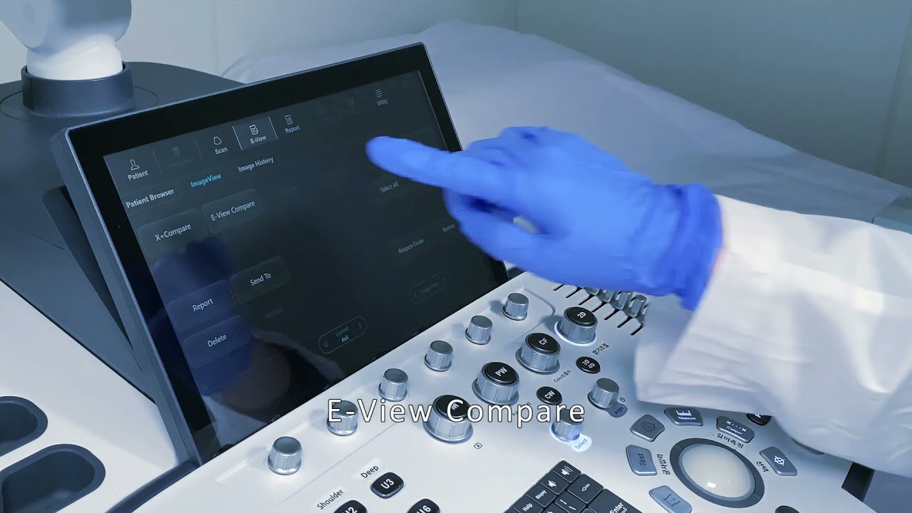 Alpinion X-Cube 90 - X+ Compare Feature