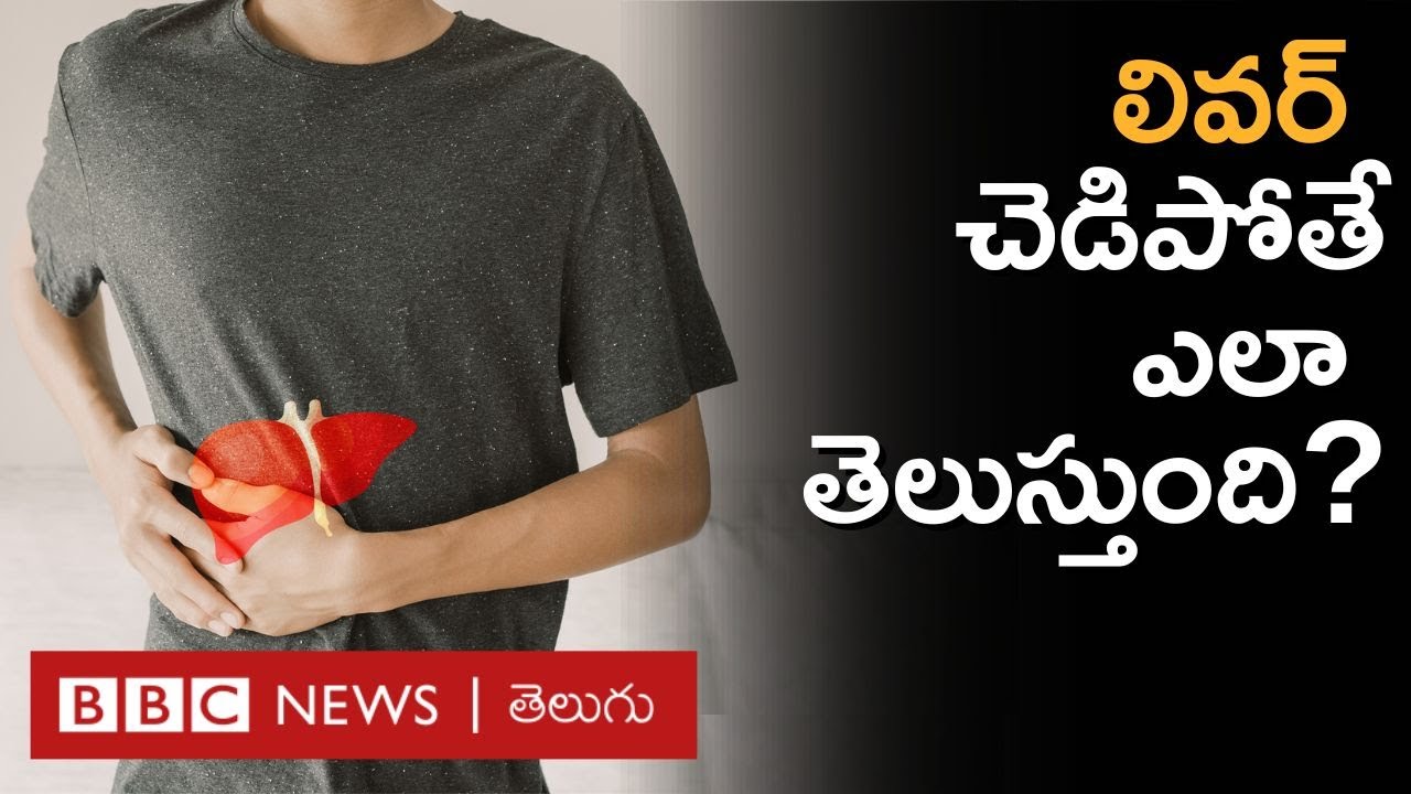 Liver Transplant: కాలేయ మార్పిడితో సైడ్ ఎఫెక్ట్స్ ఎలా ఉంటాయి? | BBC Telugu