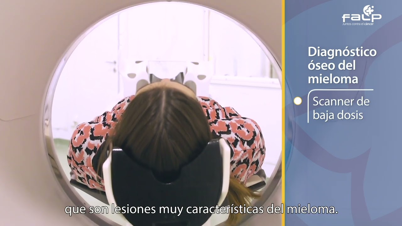 Mieloma múltiple: Síntomas, diagnóstico y tratamiento