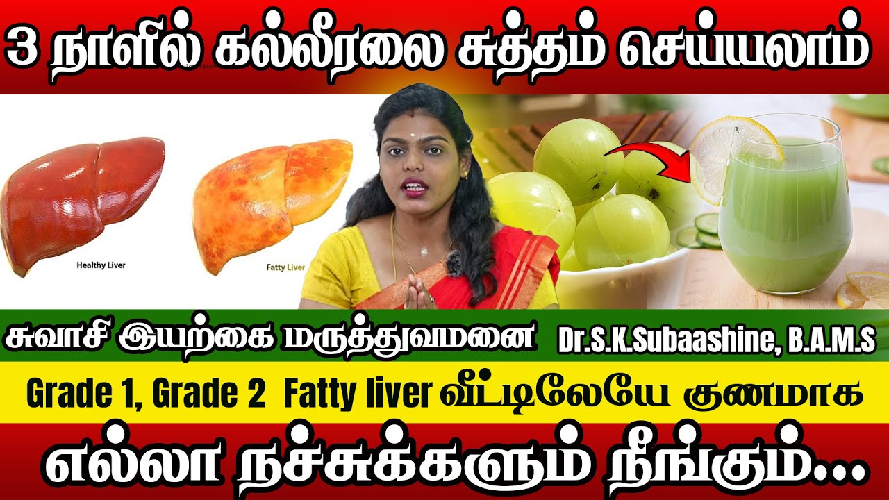 Fatty Liver : உங்க கல்லீரலை புத்தம் புதுசாக மாற்றலாம் | Dr.S.K.Subaashine