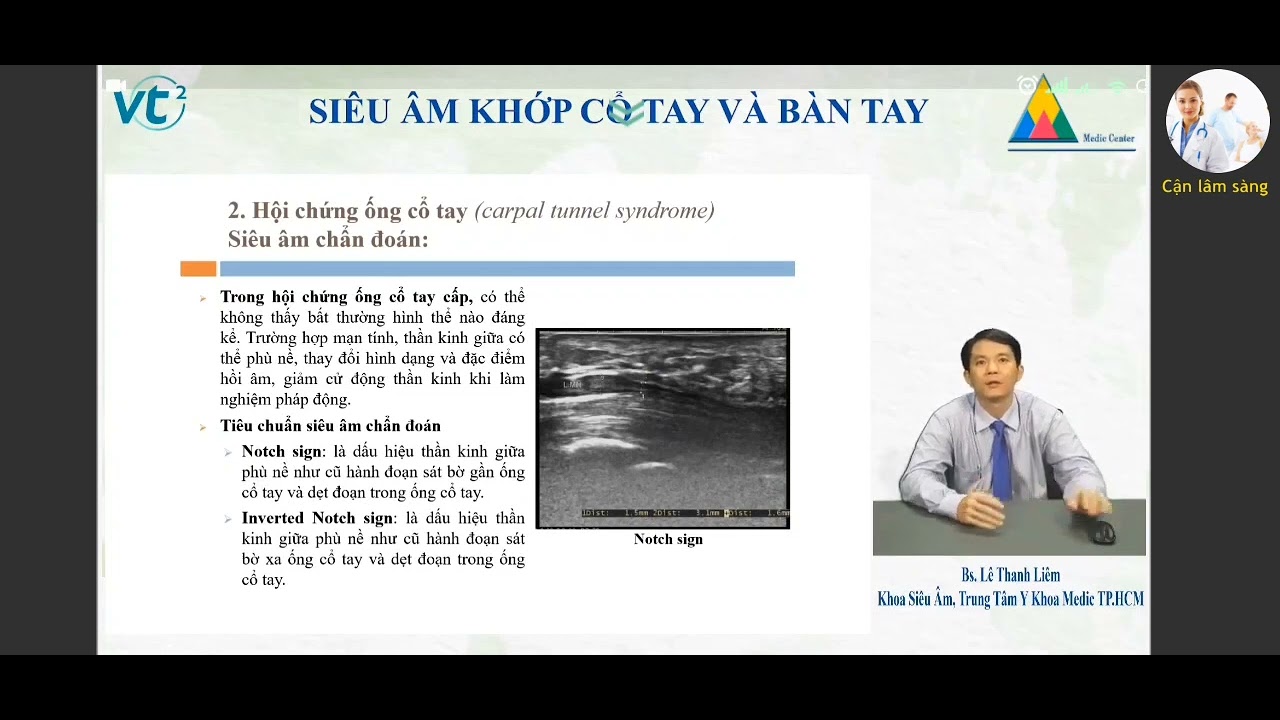 SIÊU ÂM KHỚP CỔ TAY | BS. Lê Thanh Liêm