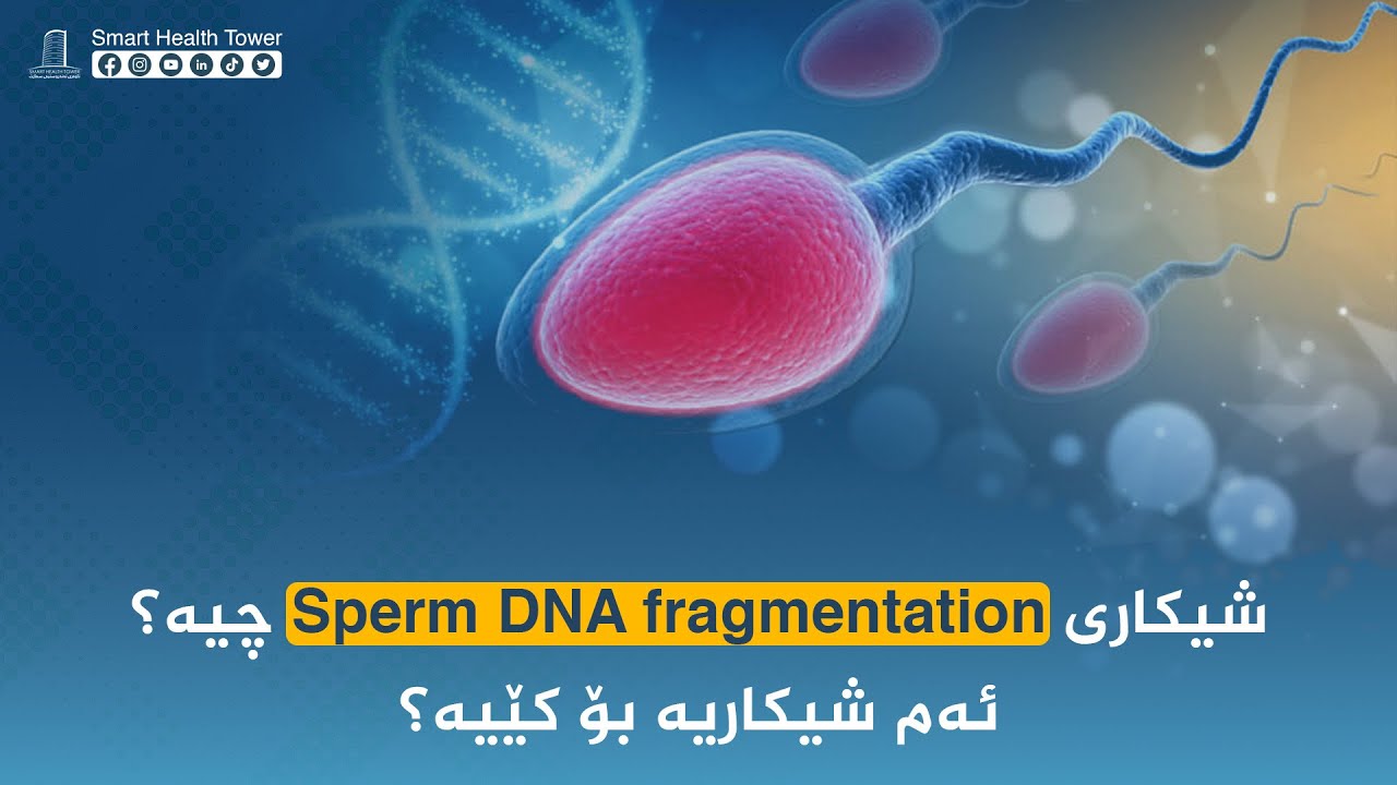 چییە؟ sperm DNA  fragmentation شیکاری