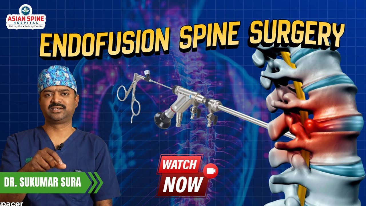EndoFusion Explained: The Future of Minimally Invasive Spine Surgery | Dr. Sukumar Sura #asianspine