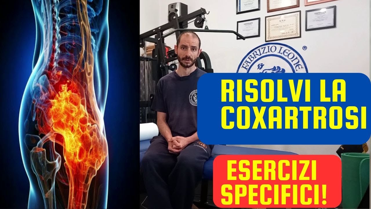 Coxartrosi: Sintomi, Trattamenti ed ESERCIZI per ELIMINARE il Dolore
