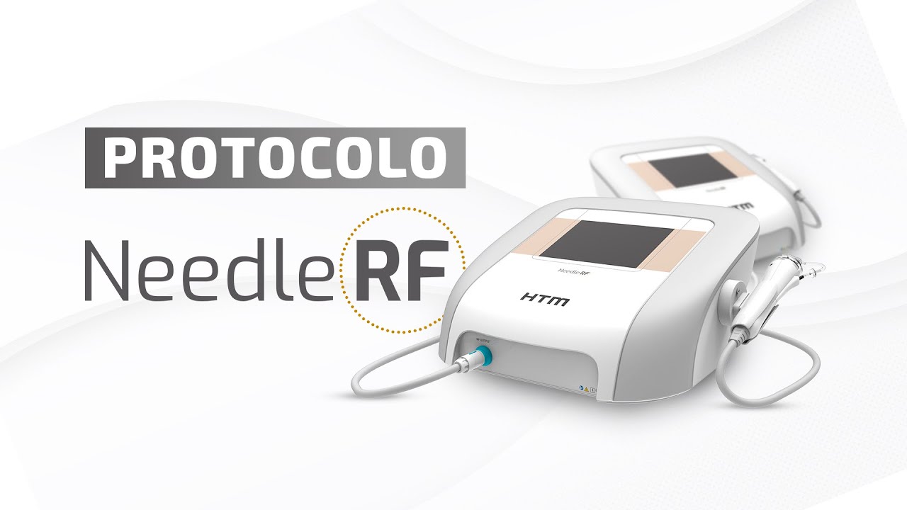 PROTOCOLO NEEDLE RF - Radiofrequência Microagulhada |  HTM ELETRÔNICA
