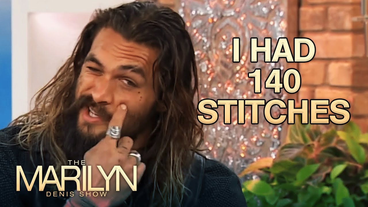 Jason Momoa Reveals How He Got That Iconic Scar | The Marilyn Denis Show